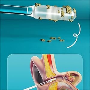 2TWISTTHINKMOREEarwaxCleanerStickSiliconeReusableStickyEarwaxRemovalKitEarCleani